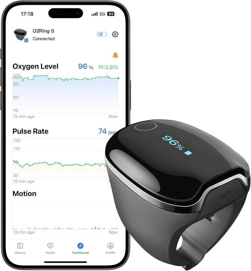 Wellue O2Ring-S Sleep Pulse Oximeter Bluetooth with Vibration Reminder, 24 Hour Battery Life